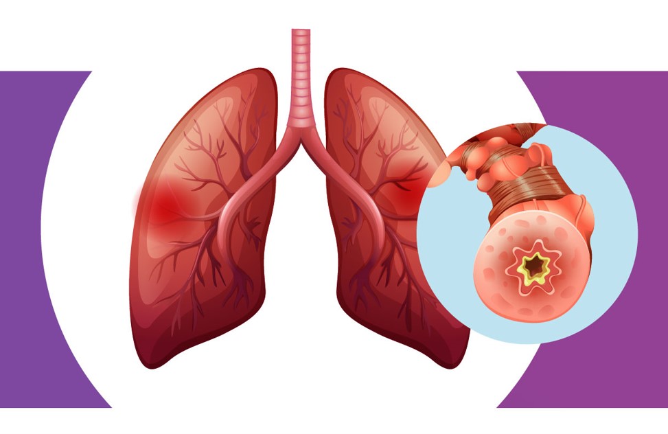 lungs